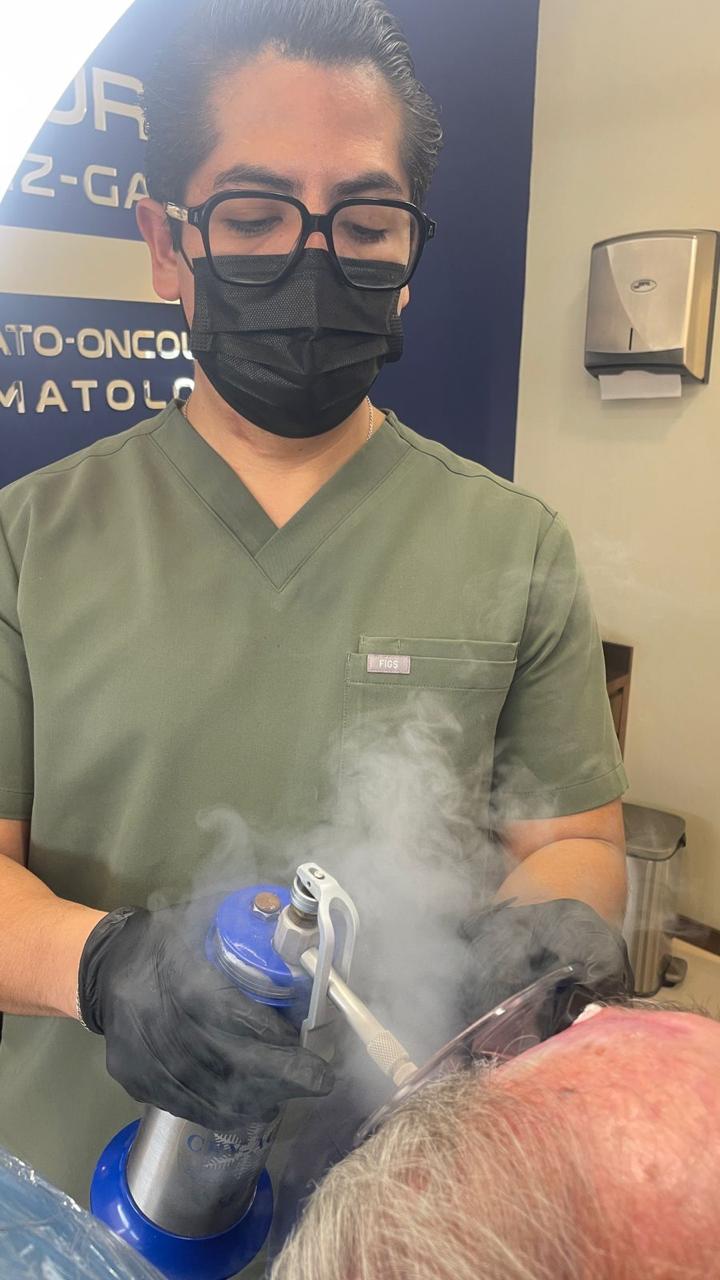 Crioterapia